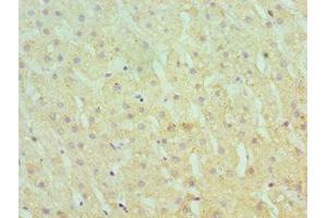 Immunohistochemistry of paraffin-embedded human liver tissue using ABIN7166367 at dilution of 1:100 (SERPINA1 Antikörper  (AA 165-444))
