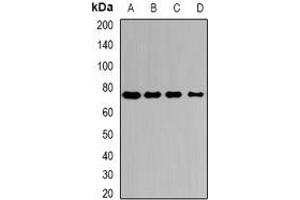 Western blot analysis of Citrin expression in HepG2 (A), Hela (B), mouse liver (C), mouse kidney (D) whole cell lysates. (slc25a13 Antikörper)
