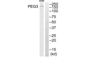 Western Blotting (WB) image for anti-Paternally Expressed 3 (PEG3) (Internal Region) antibody (ABIN1849956) (PEG3 Antikörper  (Internal Region))