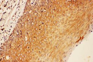 Immunohistochemistry (IHC) image for anti-Suppressor of Cytokine Signaling 3 (SOCS3) (AA 71-85), (Middle Region) antibody (ABIN3044272)