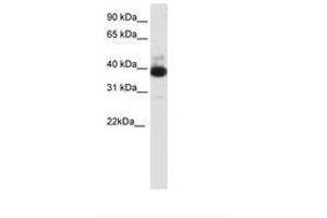Image no. 1 for anti-Tetratricopeptide Repeat Domain 19 (TTC19) (C-Term) antibody (ABIN202316) (TTC19 Antikörper  (C-Term))