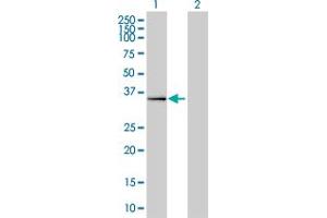 Western Blotting (WB) image for anti-Zinc finger protein ubi-d4 (DPF2) (AA 56-155) antibody (ABIN562628)