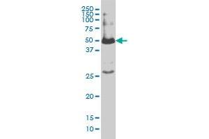 SMAD1 monoclonal antibody (M02), clone 1D3 Western Blot analysis of SMAD1 expression in IMR-32 .