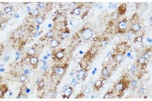 Immunohistochemistry of paraffin-embedded Human liver using IGF2BP3 Polyclonal Antibody at dilution of 1:100 (40x lens). (IGF2BP3 Antikörper)