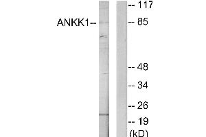 Western blot analysis of extracts from HeLa cells, using ANKK1 antibody. (ANKK1 Antikörper)
