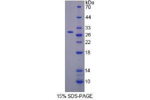 Image no. 1 for Cysteine-Rich Secretory Protein 3 (CRISP3) (AA 21-243) protein (His tag) (ABIN4990394) (CRISP3 Protein (AA 21-243) (His tag))
