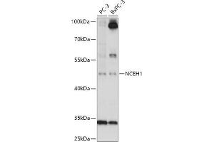 Western blot analysis of extracts of various cell lines, using NCEH1 antibody (ABIN7268897) at 1:1000 dilution. (NCEH1 Antikörper  (AA 90-440))