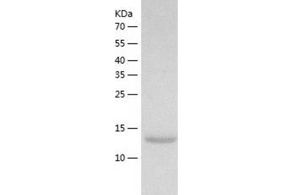 PFDN4 Protein (AA 1-134) (His tag)