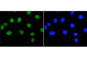 A549 cells were stained with Rb(S807) (2D10) Monoclonal Antibody  at [1:200] incubated for overnight at 4C, followed by secondary antibody incubation and DAPI staining. (Retinoblastoma 1 Antikörper  (pSer807))