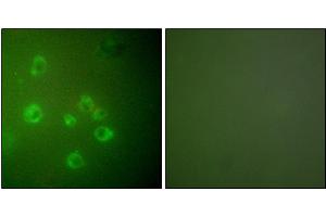 Immunofluorescence analysis of COS7 cells, using GRP78 antibody. (GRP78 Antikörper)