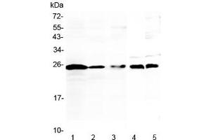 Western blot testing of 1) human Jurkat, 2) human K562, 3) human Raji, 4) rat thymus and 5) mouse thymus lysate with IL-36 alpha antibody at 0. (IL36A/IL1F6 Antikörper)
