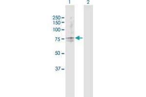 Western Blotting (WB) image for anti-Transporter 2, ATP-Binding Cassette, Sub-Family B (MDR/TAP) (TAP2) (AA 1-686) antibody (ABIN520697)