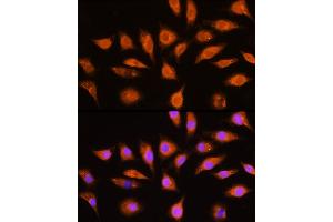 Immunofluorescence (IF) image for anti-Guanine Nucleotide Binding Protein (G Protein), alpha Inhibiting Activity Polypeptide 3 (GNAI3) (AA 1-354) antibody (ABIN6141204)