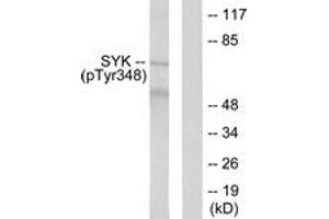 Western blot analysis of extracts from COS7 cells treated with EGF 200ng/ml 30', using SYK (Phospho-Tyr348) Antibody. (SYK Antikörper  (pTyr348))