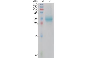 Human A Protein, hFc Tag on SDS-PAGE under reducing condition.