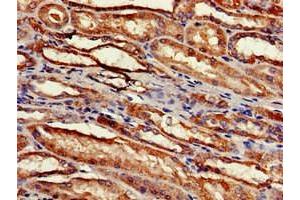 Immunohistochemistry of paraffin-embedded human kidney tissue using ABIN7142512 at dilution of 1:100 (RPS2 Antikörper  (AA 2-61))