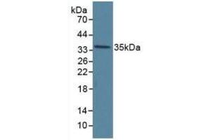Detection of ANXA5 in Human Hela Cells using Polyclonal Antibody to Annexin V (ANXA5) (Annexin V Antikörper  (AA 1-320))
