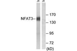 Western blot analysis of extracts from Jurkat cells, using NFAT3 (Ab-168/170) Antibody. (NFATC4 Antikörper  (AA 136-185))