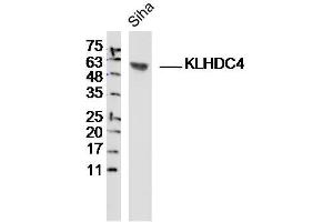 Siha lysates probed with KLHDC4 Polyclonal Antibody, Unconjugated  at 1:300 dilution and 4˚C overnight incubation. (KLHDC4 Antikörper  (AA 201-300))