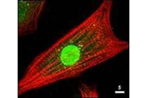 Immunofluorescence Microscopy: Rabbit anti-AKT antibody was used at a 1/80 dilution to stain cultured neonatal Rat cardiomyocytes that express a nuclear-targeted AKT construct. (AKT1 Antikörper  (C-Term))