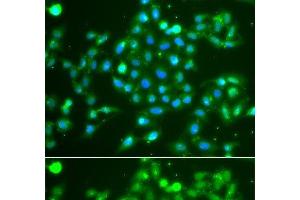 Immunofluorescence analysis of A549 cells using UCHL5 Polyclonal Antibody (UCHL5 Antikörper)