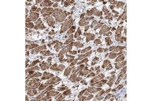 Immunohistochemical staining of human heart muscle with PPP2R3A polyclonal antibody  shows distinct cytoplasmic positivity in myocytes at 1:50-1:200 dilution. (PPP2R3A Antikörper)