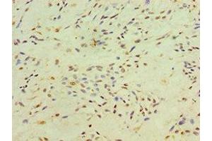 Immunohistochemistry (IHC) image for anti-X-Ray Repair Complementing Defective Repair in Chinese Hamster Cells 4 (XRCC4) (AA 1-336) antibody (ABIN7150305)