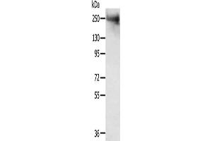 Gel: 6 % SDS-PAGE, Lysate: 40 μg, Lane: Mouse muscle tissue, Primary antibody: ABIN7192726(TACC2 Antibody) at dilution 1/300, Secondary antibody: Goat anti rabbit IgG at 1/8000 dilution, Exposure time: 5 minutes (TACC2 Antikörper)