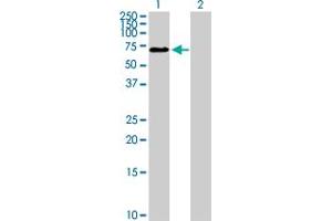 Western Blot analysis of ZNHIT6 expression in transfected 293T cell line by ZNHIT6 MaxPab polyclonal antibody. (ZNHIT6 Antikörper  (AA 1-470))