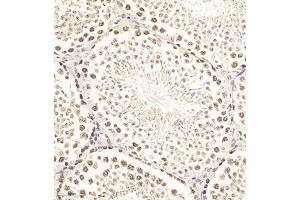 Immunohistochemistry (Paraffin-embedded Sections) (IHC (p)) image for anti-Synaptonemal Complex Protein 1 (SYCP1) antibody (ABIN7075786)