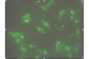 Immunofluorescence staining of human LNCap cell colony with monoclonal anti- human STEAP1 antibody (J2D2) (STEAP1 Antikörper  (AA 1-70))