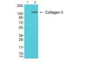 Western blot analysis of extracts from 3T3 cells (Lane 2), using Collagen II antiobdy. (COL2A1 Antikörper)