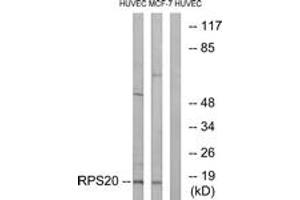 Western blot analysis of extracts from HuvEc/MCF-7 cells, using RPS20 Antibody.