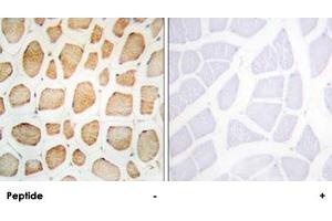 Immunohistochemistry analysis of paraffin-embedded human skeletal muscle tissue using ACTN2/ACTN3 polyclonal antibody . (ACTN2 Antikörper  (N-Term))