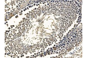 ABIN6259575 and ABIN6275740 at 1/100 staining rat testis tissue by IHC-P. (MNT Antikörper  (Internal Region))