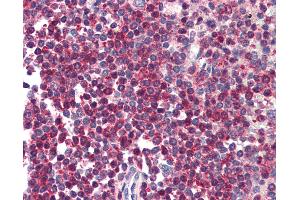 Anti-HTRA2 antibody IHC of human spleen.