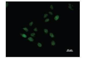 Immunostaining analysis in HeLa cells. (BTAF1 Antikörper)