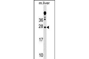 TRAT1 Antibody (Center) (ABIN1538723 and ABIN2848787) western blot analysis in mouse liver tissue lysates (35 μg/lane). (TRIM Antikörper  (AA 98-127))