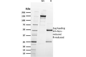 SDS-PAGE Analysis Purified CD61 Mouse Monoclonal Antibody (ITGB3/2597). (Integrin beta 3 Antikörper  (AA 385-490))