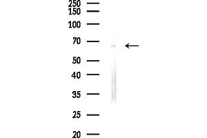 anti-Collagen, Type X (COL10) (C-Term) antibody