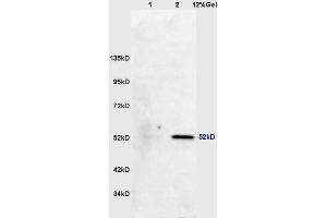 Lane 1: mouse lung lysates Lane 2: mouse brain lysates probed with Anti phospho-MAPKAPK5(Thr182) Polyclonal Antibody, Unconjugated (ABIN710546) at 1:200 in 4 °C. (MAPKAP Kinase 5 Antikörper  (pThr182))