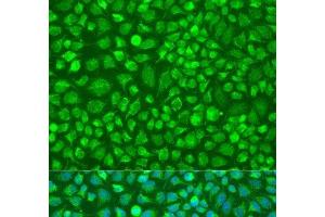 Immunofluorescence analysis of U2OS cells using DNAL1 Polyclonal Antibody at dilution of 1:100. (DNAL1 Antikörper)
