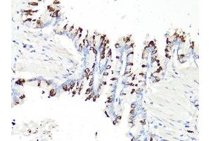 Immunohistochemistry of paraffin-embedded rat bronchial epithelium using PDCD1 antibody (ABIN6290170) at dilution of 1:100 (40x lens). (PD-1 Antikörper)