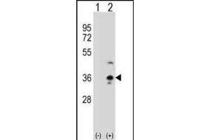 Western blot analysis of COLEC11 (arrow) using rabbit polyclonal COLEC11 Antibody (N-term) (ABIN390822 and ABIN2841053).