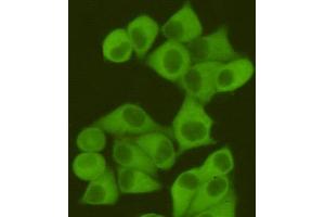Immunocytochemistry staining of Hela cells fixed with 4 % Paraformaldehyde and using anti-Fatty Acid Synthase mouse mAb (dilution 1:400). (Fatty Acid Synthase Antikörper)