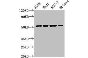 Western Blot Positive WB detected in: A549 whole cell lysate, Raji whole cell lysate, MCF-7 whole cell lysate, Rat spleen tissue All lanes: SERPINC1 antibody at 2. (SERPINC1 Antikörper  (AA 37-180))