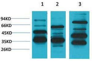 Western Blotting (WB) image for anti-MAS1 Oncogene (MAS1) antibody (ABIN3179049) (MAS1 Antikörper)