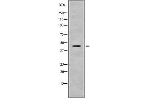 Western blot analysis of KCNJ15 using HeLa whole cell lysates (KCNJ15 Antikörper  (C-Term))
