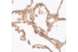 Immunohistochemistry (IHC) image for anti-Arylsulfatase B (ARSB) (C-Term) antibody (ABIN2457880) (Arylsulfatase B Antikörper  (C-Term))