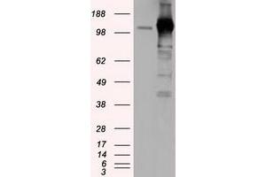 Image no. 7 for anti-Transforming, Acidic Coiled-Coil Containing Protein 3 (TACC3) antibody (ABIN1498096)